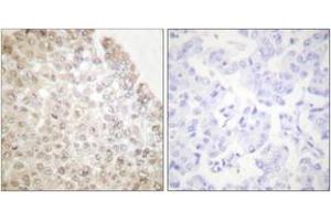 Immunohistochemistry (IHC) image for anti-Histone Deacetylase 5 (HDAC5) (AA 1073-1122) antibody (ABIN2889210) (HDAC5 抗体  (AA 1073-1122))