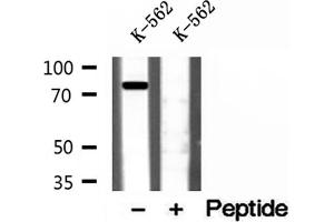 Western blot analysis of extracts of K-562 cells, using Coilin antibody.