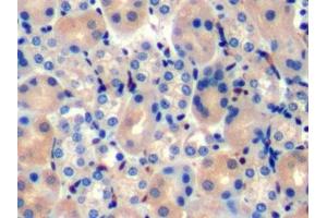 Immunohistochemistry (IHC) image for anti-Notch 1 (NOTCH1) (AA 1919-2079) antibody (ABIN7445663)