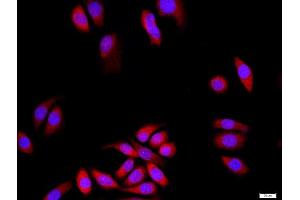 MCF-7 cells were stained with DLG1+3 Polyclonal Antibody, Unconjugated at 1:500 in PBS and incubated for two hours at 37°C followed by Goat Anti-Rabbit IgG (H+L) Cy3 conjugated secondary antibody. (DLG3 抗体  (AA 501-600))