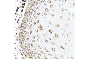 Immunohistochemistry of paraffin-embedded human esophagus using RAC2 antibody (ABIN5970487) at dilution of 1/100 (40x lens). (RAC2 抗体)