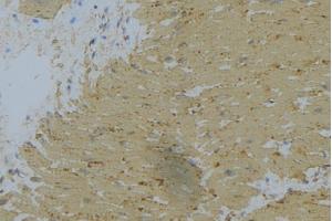 ABIN6269398 at 1/100 staining Mouse muscle tissue by IHC-P. (WNK1 抗体  (N-Term))