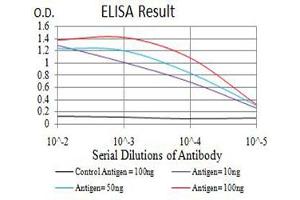 Black line: Control Antigen (100 ng),Purple line: Antigen (10 ng), Blue line: Antigen (50 ng), Red line:Antigen (100 ng) (IGLC2 抗体  (AA 1-106))