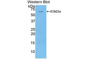 Western Blotting (WB) image for anti-Sulfatase 1 (SULF1) (AA 609-871) antibody (ABIN1860661) (SULF1 抗体  (AA 609-871))