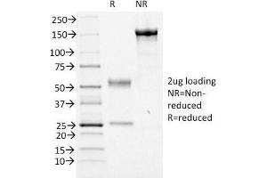 SDS-PAGE Analysis Purified FOXA1 Mouse Monoclonal Antibody (FOXA1/1516).