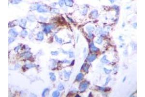 Immunohistochemistry (IHC) image for anti-Transforming Growth Factor, beta 1 (TGFB1) antibody (ABIN181152)
