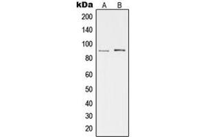 Western blot analysis of cGK 2 expression in HeLa (A), Hs67 (B) whole cell lysates. (PRKG2 抗体  (Center))