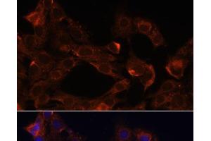 Immunofluorescence analysis of C6 cells using NRP1 Polyclonal Antibody at dilution of 1:100. (Neuropilin 1 抗体)