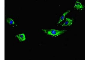 Immunofluorescent analysis of Hela cells using ABIN7168509 at dilution of 1:100 and Alexa Fluor 488-congugated AffiniPure Goat Anti-Rabbit IgG(H+L) (RYR2 抗体  (AA 901-1192))
