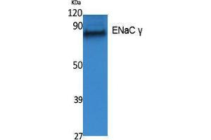 Western Blotting (WB) image for anti-Sodium Channel, Nonvoltage-Gated 1, gamma (SCNN1G) (Internal Region) antibody (ABIN3187601)