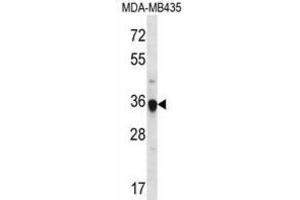 Western Blotting (WB) image for anti-Fibrinogen-Like 1 (FGL1) antibody (ABIN2996869) (FGL1 抗体)