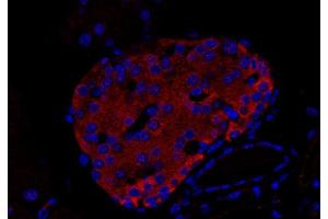 Immunohistochemistry (IHC) image for anti-Uncoating ATPase (AA 1-650) antibody (ABIN1742323)