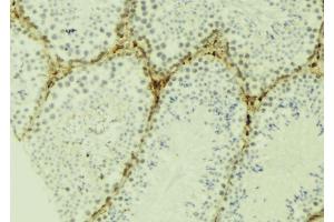 ABIN6277135 at 1/100 staining Mouse testis tissue by IHC-P. (SPDYA 抗体  (Internal Region))