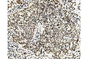 IHC analysis of RCC1 using anti-RCC1 antibody (ABIN7600024). (RCC1 抗体  (AA 14-421))