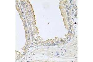 Immunohistochemistry of paraffin-embedded human prostate using ANKH antibody. (ANKH 抗体)