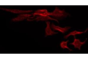Immunofluorescence (fixed cells) (IF/ICC) image for anti-ATP-Binding Cassette, Sub-Family C (CFTR/MRP), Member 3 (ABCC3) (Internal Region) antibody (ABIN6259516)