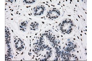 Immunohistochemical staining of paraffin-embedded breast tissue using anti-TYRO3 mouse monoclonal antibody. (TYRO3 抗体)