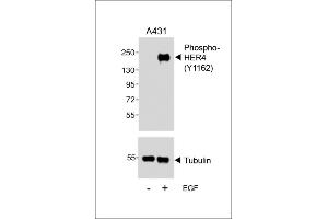Western blot analysis of lysates from A431 cell line, untreated or treated with EGF, 100 ng/mL, using (ABIN389572 and ABIN2839598) (upper) or Tubulin (lower). (ERBB4 抗体  (pTyr1162))