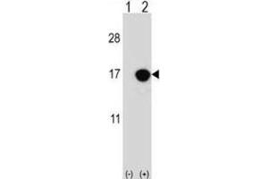 Western Blotting (WB) image for anti-Cyclin-Dependent Kinase Inhibitor 2B (p15, Inhibits CDK4) (CDKN2B) antibody (ABIN2996859) (CDKN2B 抗体)
