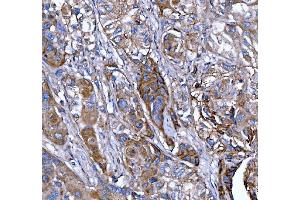 IHC analysis of Kindlin 2/FERMT2 using anti-Kindlin 2/FERMT2 antibody (ABIN7599515). (FERMT2 抗体  (AA 1-650))
