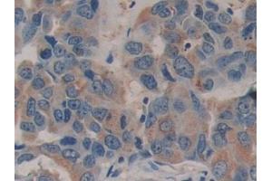 Immunohistochemistry (IHC) image for anti-Family with Sequence Similarity 3, Member C (FAM3C) (AA 25-227) antibody (ABIN7443470)