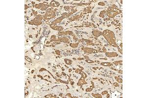 IHC analysis of Citrin/SLC25A13 using anti-Citrin/SLC25A13 antibody (ABIN7599512). (slc25a13 抗体  (AA 1-643))