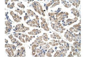 GTPBP9 antibody was used for immunohistochemistry at a concentration of 4-8 ug/ml to stain Skeletal muscle cells (arrows) in Human Muscle. (OLA1 抗体)