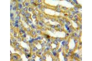 Immunohistochemistry (IHC) image for anti-Platelet-Activating Factor Acetylhydrolase 1b, Catalytic Subunit 3 (29kDa) (PAFAH1B3) (AA 28-231) antibody (ABIN1860117)