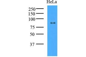 Western Blotting (WB) image for anti-K(lysine) Acetyltransferase 2A (KAT2A) (AA 411-837) antibody (ABIN487349) (KAT2A 抗体  (AA 411-837))