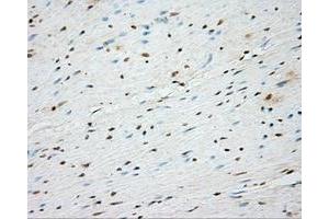 Immunohistochemistry (IHC) image for anti-Bruton Agammaglobulinemia tyrosine Kinase (BTK) antibody (ABIN1496976) (BTK 抗体)