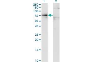 Western Blot analysis of DMD expression in transfected 293T cell line by DMD monoclonal antibody (M07), clone 3A11. (Dystrophin 抗体  (AA 1-635))