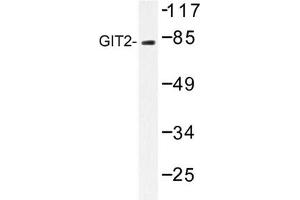 Image no. 1 for anti-G Protein-Coupled Receptor Kinase Interactor 2 (GIT2) antibody (ABIN272229) (GIT2 抗体)