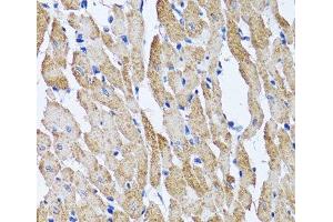 Immunohistochemistry (Paraffin-embedded Sections) (IHC (p)) image for anti-ATP Synthase, H+ Transporting, Mitochondrial F1 Complex, beta Polypeptide (ATP5B) antibody (ABIN7010818)