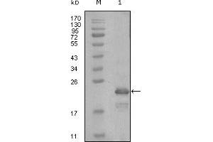 Western blot analysis using HAND1 mouse mAb against truncated Trx-HAND1 recombinant protein (1). (HAND1 抗体)