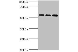 Western blot All lanes: Acyl-coenzyme A synthetase ACSM3, mitochondrial antibody at 10 μg/mL Lane 1: 293T whole cell lysate Lane 2: Mouse kidney tissue Lane 3: A431 whole cell lysate Secondary Goat polyclonal to rabbit IgG at 1/10000 dilution Predicted band size: 67, 50 kDa Observed band size: 67 kDa (ACSM3 抗体  (AA 387-586))