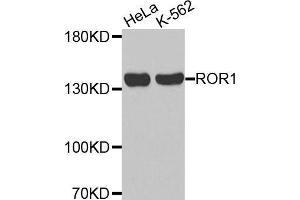 Western blot analysis of extracts of various cell lines, using ROR1 antibody. (ROR1 抗体  (AA 30-200))