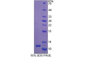 SDS-PAGE analysis of Mouse SYMPK Protein. (Symplekin Protein (SYMPK))