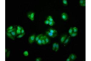 Immunofluorescence staining of HepG2 cells with ABIN7175545 at 1:66, counter-stained with DAPI. (PROS1 抗体  (AA 42-676))