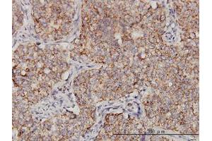 Image no. 1 for anti-Protoporphyrinogen Oxidase (PPOX) (AA 378-478) antibody (ABIN598883) (PPOX 抗体  (AA 378-478))