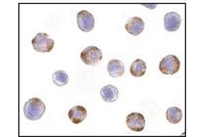 Image no. 3 for anti-Nucleotide-Binding Oligomerization Domain Containing 2 (NOD2) (C-Term) antibody (ABIN372922) (NOD2 抗体  (C-Term))