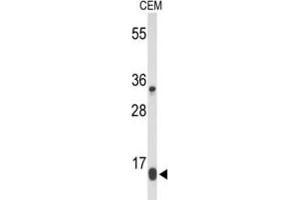 Western Blotting (WB) image for anti-DIRAS Family, GTP-Binding RAS-Like 1 (DIRAS1) antibody (ABIN5024693) (DIRAS1 抗体)