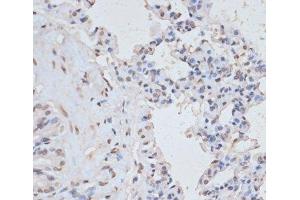 Immunohistochemistry of paraffin-embedded Rat lung using Phospho-MAPK3(Y204) Polyclonal Antibody at dilution of 1:100 (40x lens).