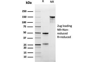 SDS-PAGE Analysis Purified CD47 Mouse Monoclonal Antibody (IAP/964). (CD47 抗体)