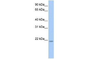 WB Suggested Anti-RNF5 Antibody Titration: 0. (RNF5 抗体  (N-Term))