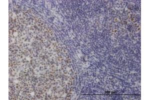 Immunoperoxidase of monoclonal antibody to TOE1 on formalin-fixed paraffin-embedded human tonsil. (TOE1 抗体  (AA 1-510))