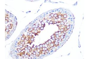 Immunohistochemistry of paraffin-embedded rat testis using EBP1/PG4 Rabbit mAb (ABIN7269550) at dilution of 1:100 (40x lens).