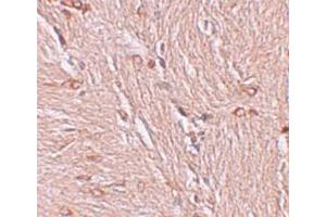 Immunohistochemistry (IHC) image for anti-Zinc Finger and BTB Domain Containing 4 (ZBTB4) (C-Term) antibody (ABIN1030812) (ZBTB4 抗体  (C-Term))