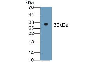 Detection of Recombinant APOB100, Cattle using Polyclonal Antibody to Apolipoprotein B100 (APOB100) (Apo-B100 抗体  (AA 4331-4567))