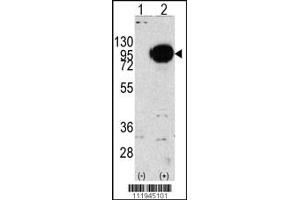 Western blot analysis of PYGM using rabbit polyclonal PYGM Antibody using 293 cell lysates (2 ug/lane) either nontransfected (Lane 1) or transiently transfected with the PYGM gene (Lane 2). (PYGM 抗体  (C-Term))
