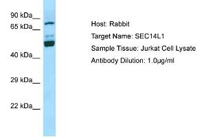 Western Blotting (WB) image for anti-SEC14-Like 1 (SEC14L1) (N-Term) antibody (ABIN2790166) (SEC14L1 抗体  (N-Term))